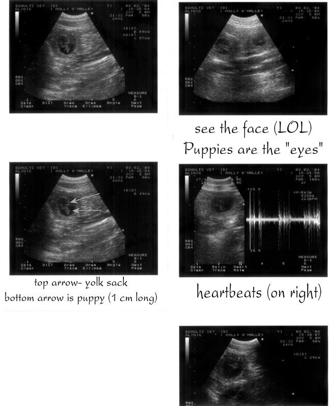 ultrasound